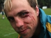 Phil-Waugh-eye-cut-CT